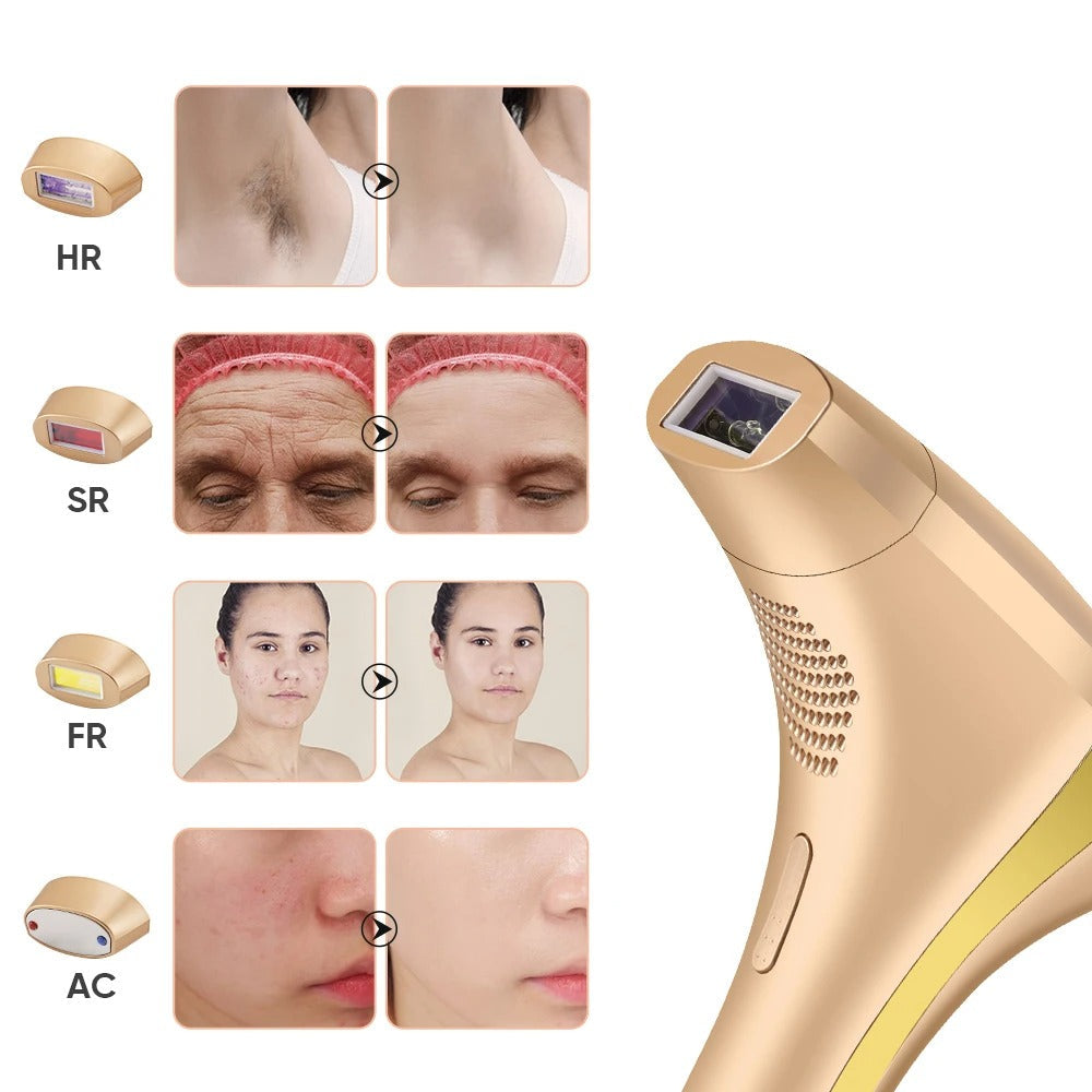 Permanent IPL Hair Removal with Skin Rejuvenation & Acne Care, 8 Energy Levels Golden