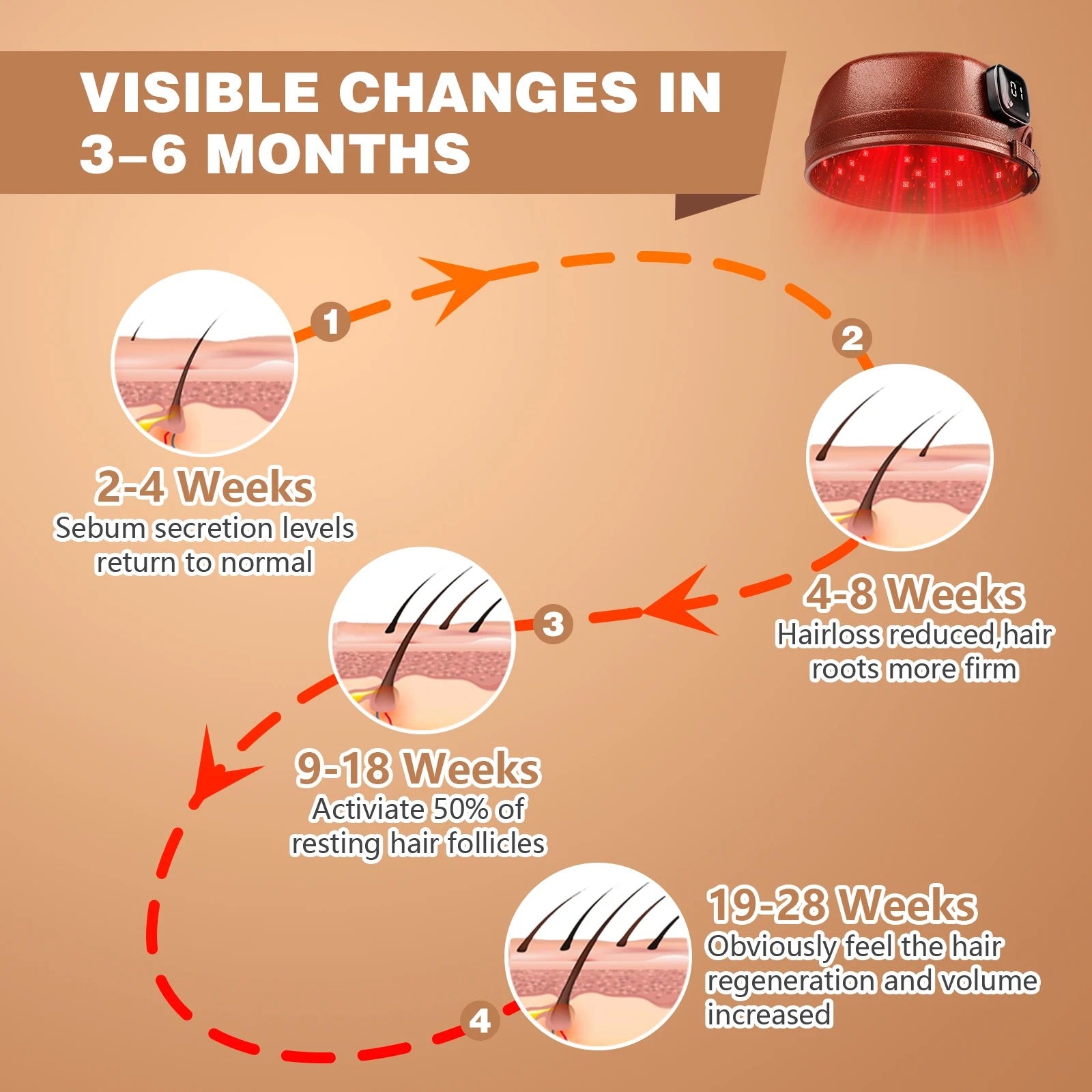 Portable Laser Hair Regrowth Cap 660nm/850nm, Cordless 3000mAh Red Light Therapy for Thinning Hair